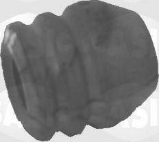 Отбойник амортизатора (стойки) Sasic. Артикул 2656014